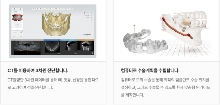 임플란트수명? 이렇게 해야 20년 이상 쓰실 수 있습니다. 관련 이미지 6