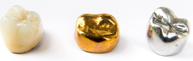 어금니크라운가격 궁금하세요 이것만큼은 알고 가세요 관련 이미지 5