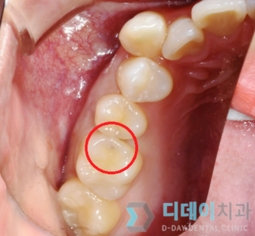 강남구청역치과? 방문 전 OOOO부터 확인하세요. 관련 이미지 4