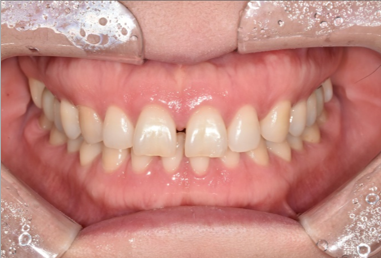 삼성중앙역치과? 전문의 밝히는 진실 관련 이미지 1