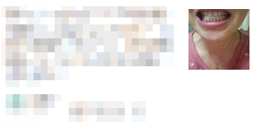 치과치아미백, 700명 이상이 디데이치과를 선택한 이유? 관련 이미지 7