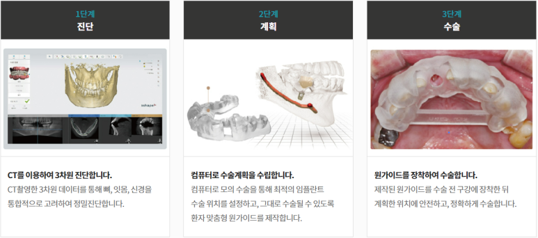 네비게이션임플란트, 무조건 성공하는 것은 아닌 이유? 관련 이미지 3