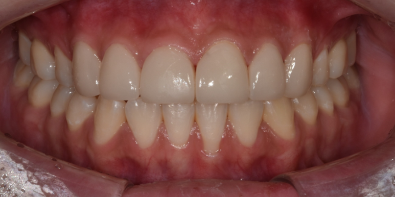 라미네이트색상, 모양 후회 안하려면? 관련 이미지 5