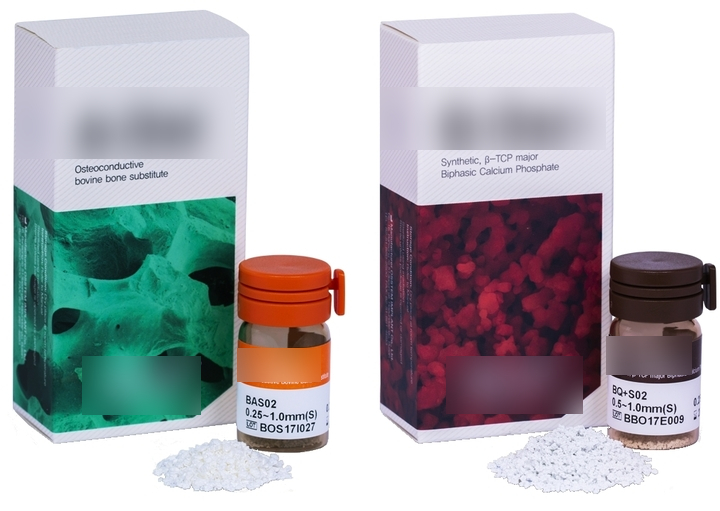 뼈이식임플란트 대상, 종류, 비용까지 전부 공개합니다. 관련 이미지 3