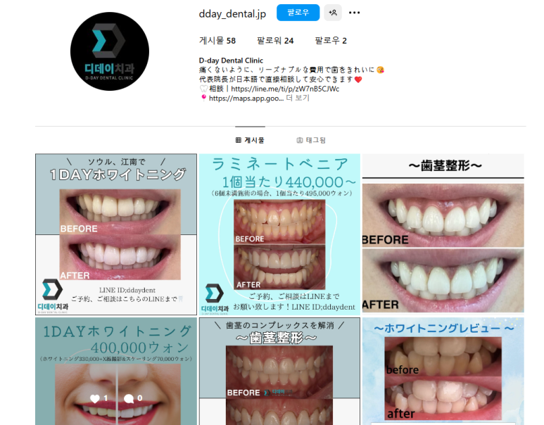 최소증상 치아미백 치과 후기,일본에서도 오는 이유? 관련 이미지 9