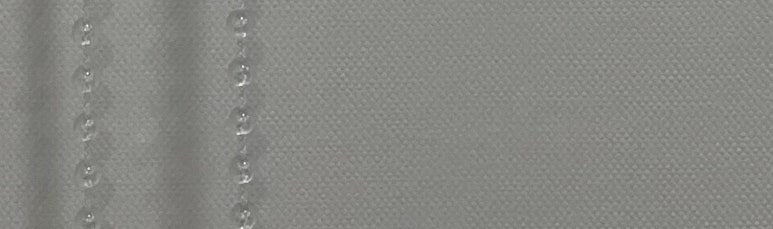 치아미백 vs 라미네이트, 누렁니 탈출하고 싶으신 분들만 관련 이미지 23