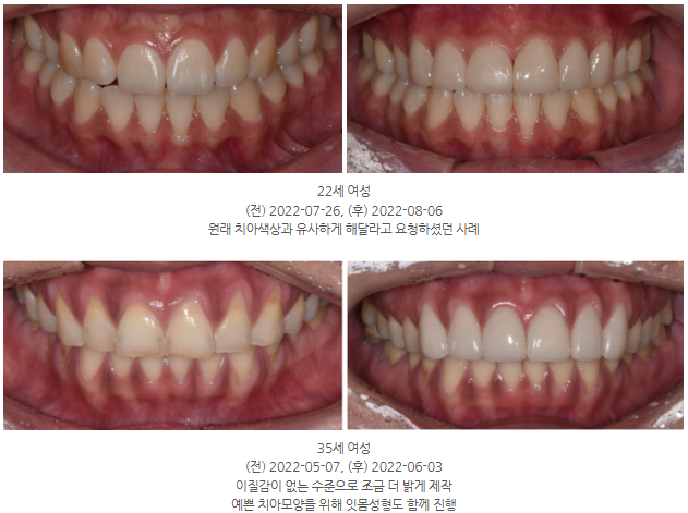 무삭제라미네이트비용, 저렴하다고 선택하면 후회합니다 관련 이미지 6