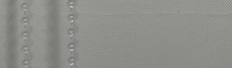 치아미백 vs 라미네이트, 누렁니 탈출하고 싶으신 분들만 관련 이미지 21