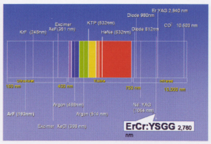 잇몸치료레이저, 받기 전 이것만은 꼭 확인하세요 관련 이미지 7