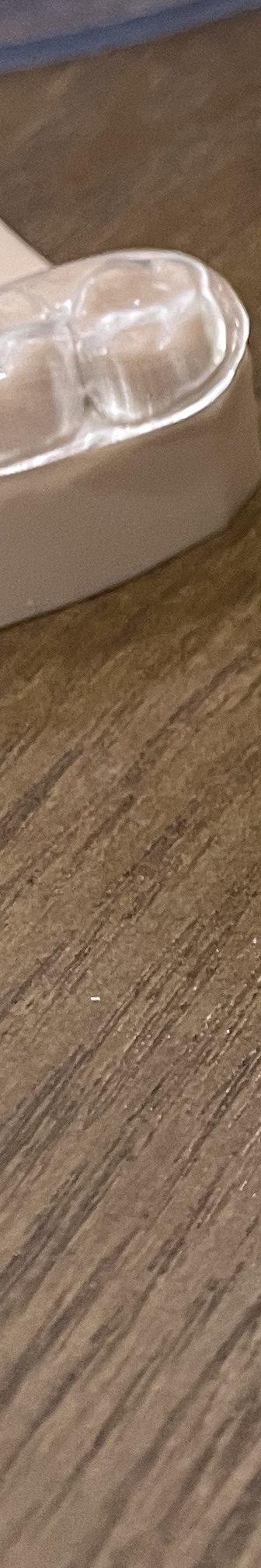 양재역 치과, 실력과 양심 두마리 토끼를 놓치지 않는 방법 관련 이미지 19