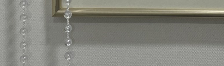 치아미백 vs 라미네이트, 누렁니 탈출하고 싶으신 분들만 관련 이미지 19