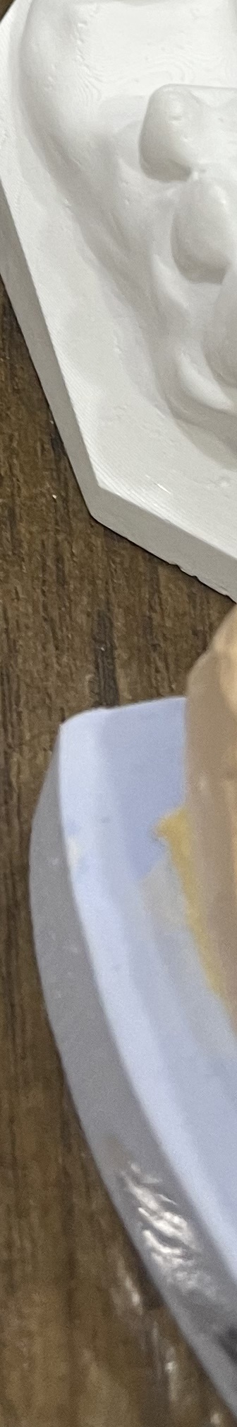 매봉역 치과, 자연치아 잃고 싶지 않다면? 관련 이미지 21