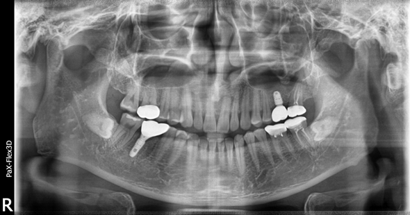 강남치과추천? 내게 꼭 맞는 치과 고르는 방법 관련 이미지 8