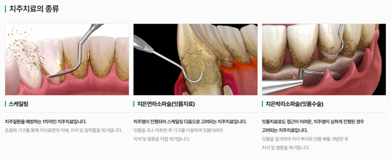 근로자의날, 5월 대체공휴일 진료하는 치과를 찾으려면? 관련 이미지 7
