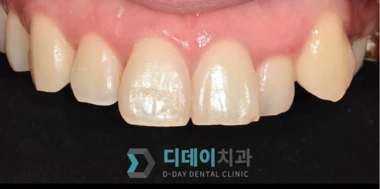 학동치과? 이 2가지는 꼭 확인하세요. 관련 이미지 1