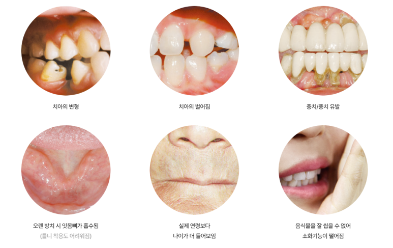 역삼동임플란트? 자주 묻는 질문 FAQ 여기서 떠먹여드립니다. 관련 이미지 3