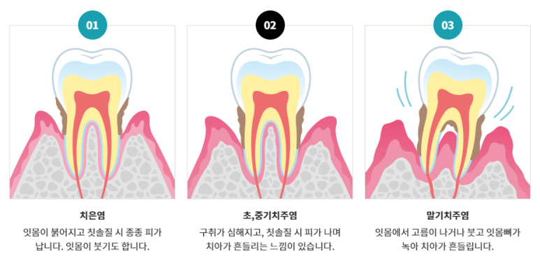 강남한글날치과, 휴일 정상진료하는 곳 찾고 계시다면? 관련 이미지 3