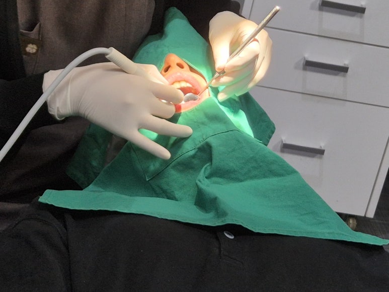 치과레진치료, 재치료 없이 오래 사용하는 방법 관련 이미지 3