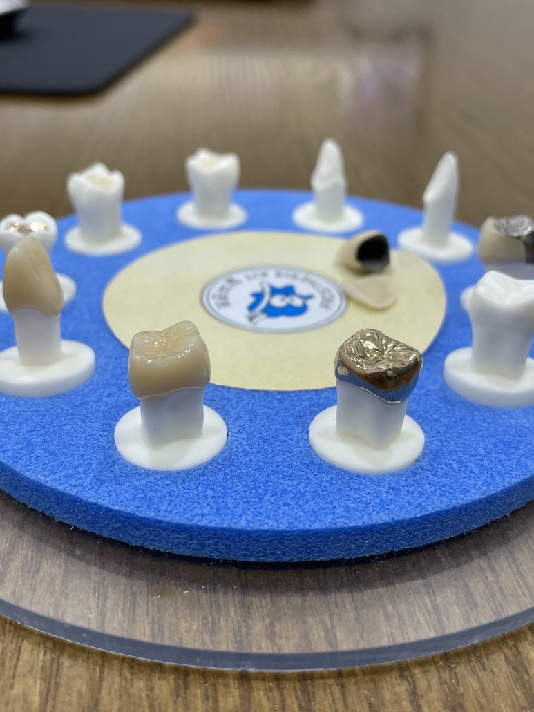 지르코니아크라운가격, 장단점과 수명까지 한번에 정리해드립니다. 관련 이미지 10