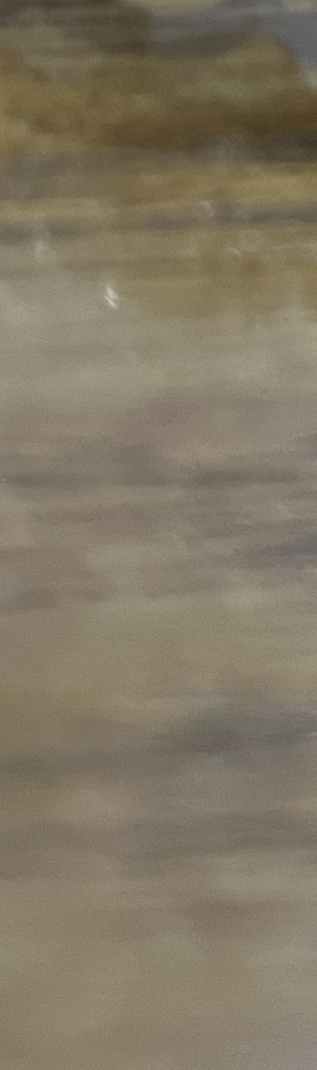 서초동 치과, 통증이 두려워 방문을 꺼리신다면? 관련 이미지 16