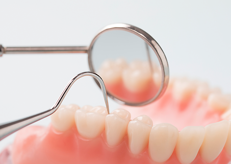 삼성역 스케일링 치과, 아무곳에서나 받으시면? 관련 이미지 2