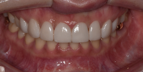 강남치과추천? 내게 꼭 맞는 치과 고르는 방법 관련 이미지 12