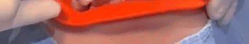 대치동치과 치아미백, 수능 끝난 직 후 졸업사진 찍기 전이 최적의 시기입니다. 관련 이미지 16