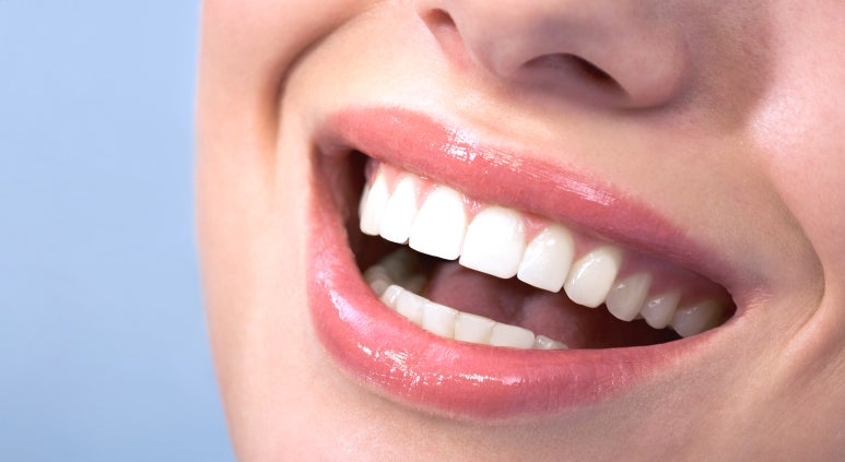 치은절제술/성형술? 잇몸이 치아를 덮고 있어 고민인 분만 관련 이미지 11