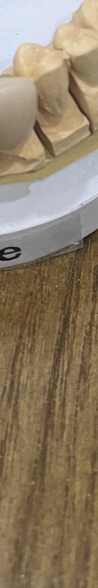 매봉역 치과, 자연치아 잃고 싶지 않다면? 관련 이미지 18