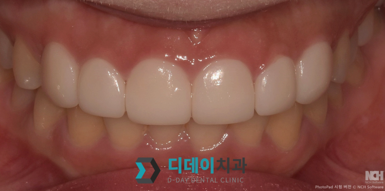 라미네이트종류, 이것만 확인하면 됩니다 관련 이미지 7