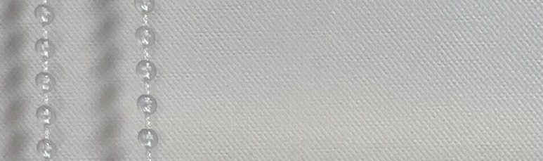 치아미백 vs 라미네이트, 누렁니 탈출하고 싶으신 분들만 관련 이미지 12