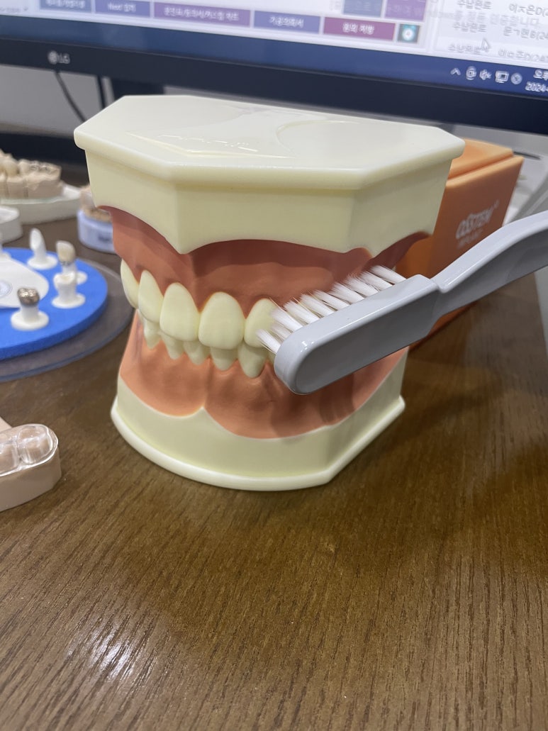 매봉역 치과, 자연치아 잃고 싶지 않다면? 관련 이미지 3