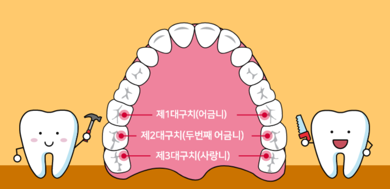 한티역 치과, 충치가 걱정이라면 딱 2가지만 확인해보세요 관련 이미지 3