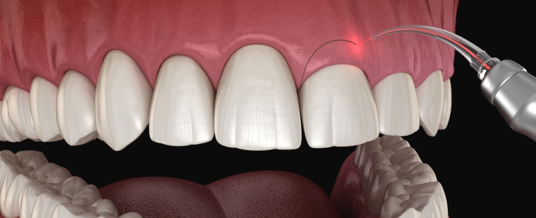 선릉치과? 치료받기 전에 꼭 알아야 할 것 관련 이미지 12