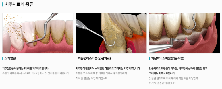 어버이날선물, 치과 검진으로 부모님 치아 건강 챙겨주세요! 관련 이미지 3