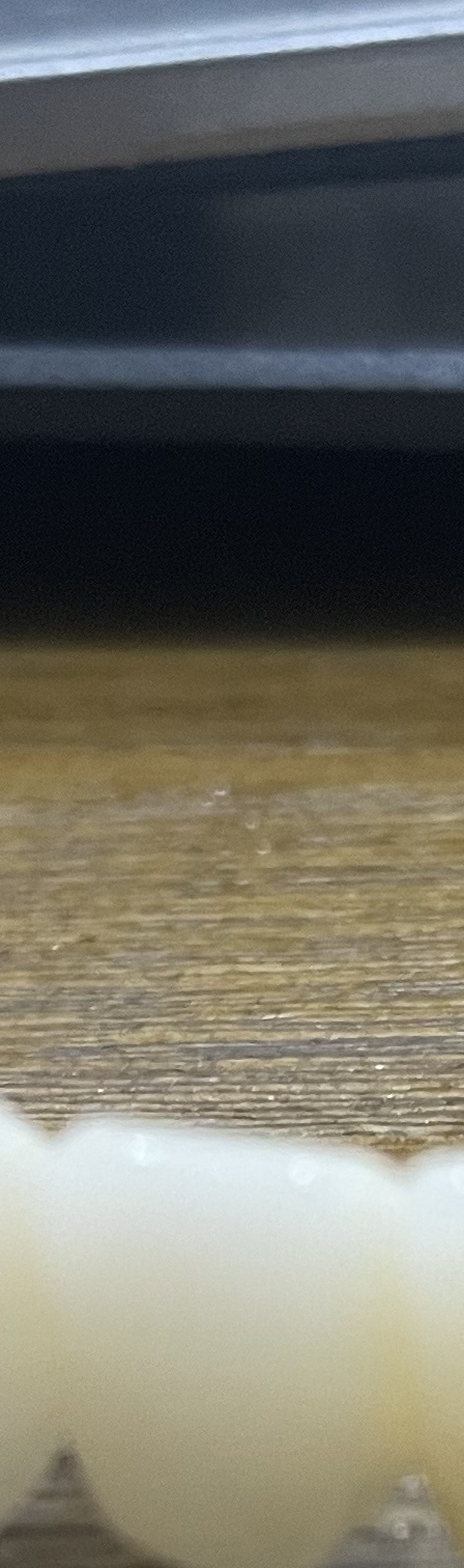 서초동 치과, 통증이 두려워 방문을 꺼리신다면? 관련 이미지 7