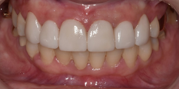 강남치과추천? 내게 꼭 맞는 치과 고르는 방법 관련 이미지 14