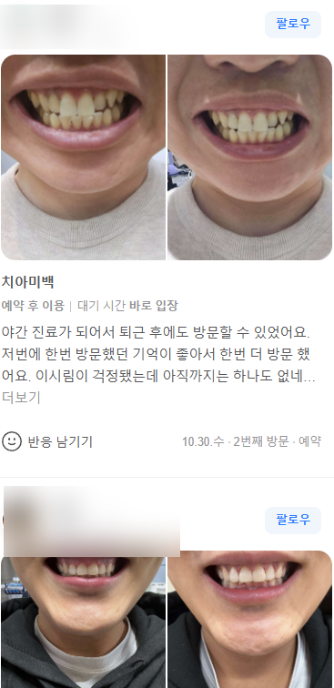 원데이 치과미백 치료? 5000건 해보고 알려드립니다. 관련 이미지 6