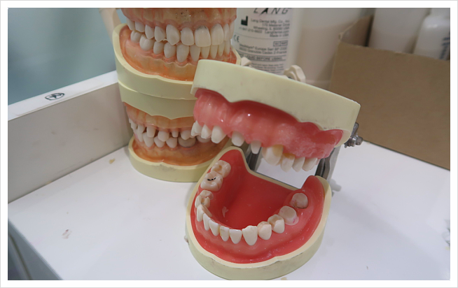 대치동 임플란트? 이 글 하나만 보셔도 좋습니다. 관련 이미지 3