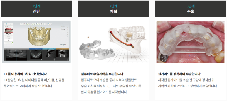 임플란트재수술, 케이스로 보여드립니다. 관련 이미지 4