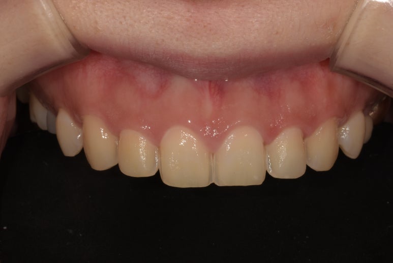 라미네이트과정, 어떻게 진행되는지 궁금하다면? 관련 이미지 5