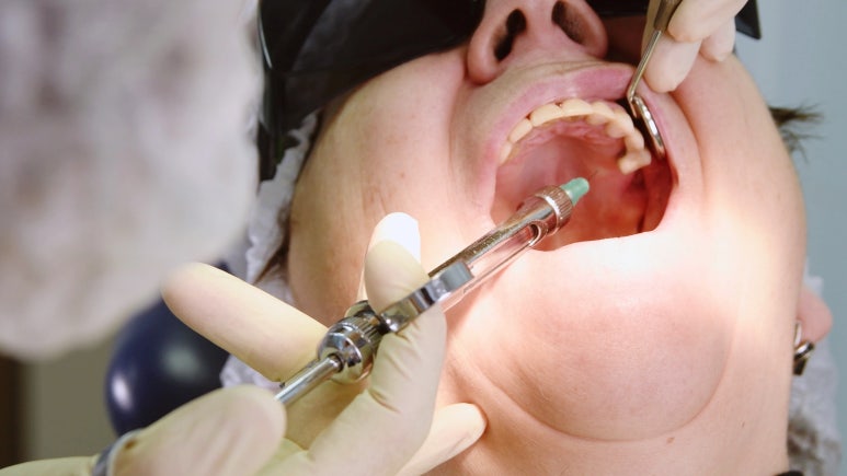 신경치료안아프게? 받고 싶으신 분들은 보세요. 관련 이미지 1