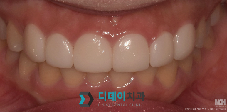 라미네이트종류, 이것만 확인하면 됩니다 관련 이미지 12