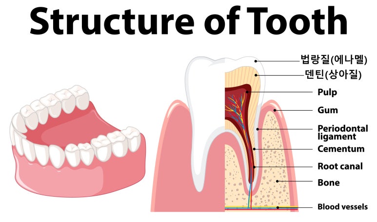치아파임으로 이가 시리다면? 치경부마모증 치료방법과 비용 알고가기 관련 이미지 6