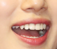 서초동 치과, 통증이 두려워 방문을 꺼리신다면? 관련 이미지 2