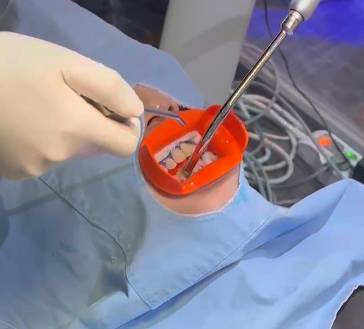 강남역치아미백, 가격보다 ‘이것’이 중요합니다 – 원장 작성 관련 이미지 5