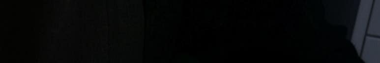 앞니뿌리충치, 치료과정 정리해드립니다. 관련 이미지 7