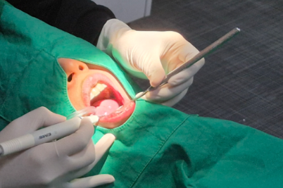 선정릉치과 라미네이트 vs 크라운, 어떤 치료가 맞을까요? 관련 이미지 9