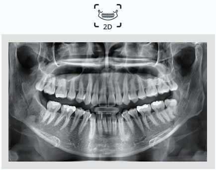 서울치과추천, 전문의가 대신 해드립니다 관련 이미지 3