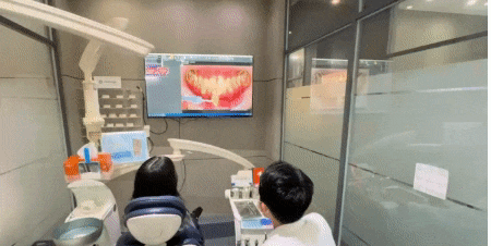 라미네이트 재시술,의사가 직접 설명합니다 관련 이미지 4